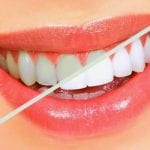 Sbiancamento dei denti: come avere denti più bianchi con il fai da te