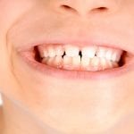 Quali denti cadono prima ai bambini: consigli utili